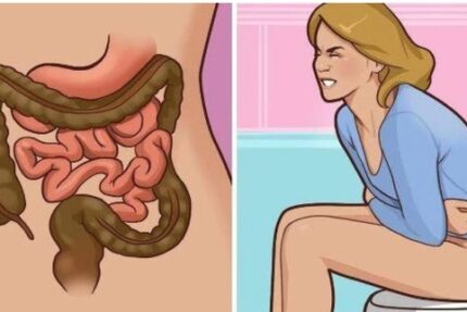 ung-thu-dai-trang-1762401090364385182811